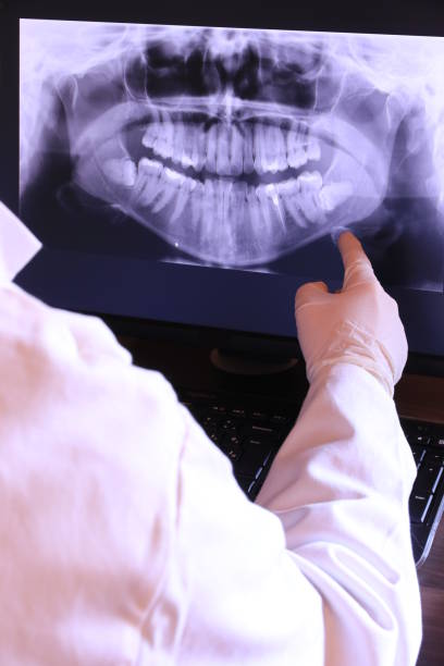 Best Mobile Emergency Dentist in Spring Valley Lake, CA